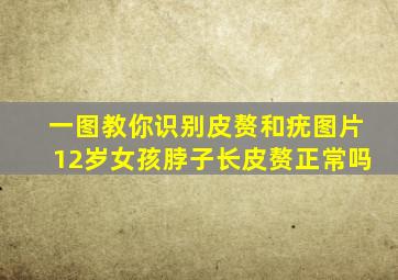 一图教你识别皮赘和疣图片12岁女孩脖子长皮赘正常吗