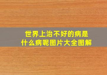 世界上治不好的病是什么病呢图片大全图解