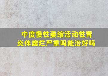 中度慢性萎缩活动性胃炎伴糜烂严重吗能治好吗