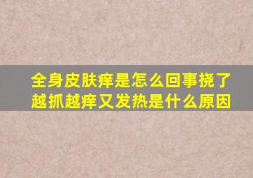 全身皮肤痒是怎么回事挠了越抓越痒又发热是什么原因