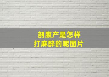 剖腹产是怎样打麻醉的呢图片