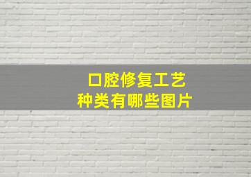 口腔修复工艺种类有哪些图片