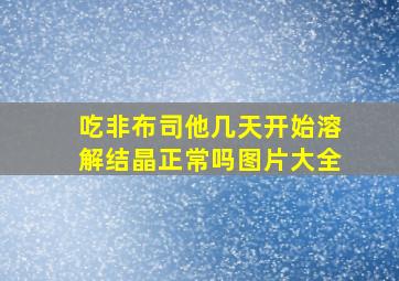 吃非布司他几天开始溶解结晶正常吗图片大全