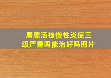 唇腺活检慢性炎症三级严重吗能治好吗图片