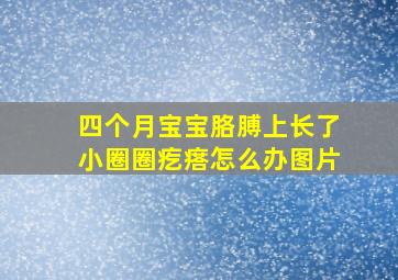 四个月宝宝胳膊上长了小圈圈疙瘩怎么办图片