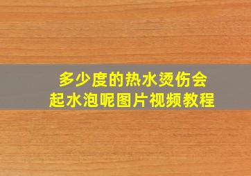 多少度的热水烫伤会起水泡呢图片视频教程