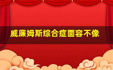 威廉姆斯综合症面容不像