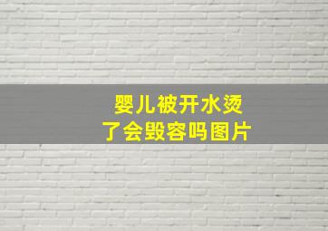 婴儿被开水烫了会毁容吗图片