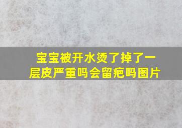 宝宝被开水烫了掉了一层皮严重吗会留疤吗图片