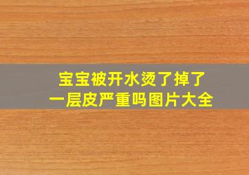 宝宝被开水烫了掉了一层皮严重吗图片大全