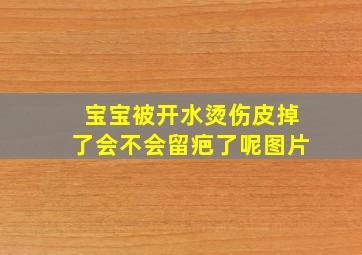 宝宝被开水烫伤皮掉了会不会留疤了呢图片