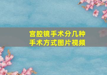 宫腔镜手术分几种手术方式图片视频