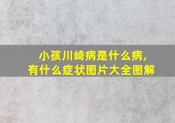 小孩川崎病是什么病,有什么症状图片大全图解