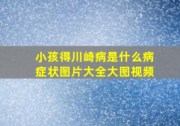 小孩得川崎病是什么病症状图片大全大图视频