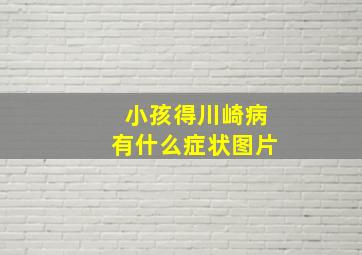 小孩得川崎病有什么症状图片