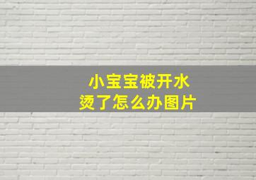 小宝宝被开水烫了怎么办图片