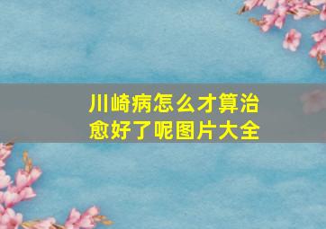 川崎病怎么才算治愈好了呢图片大全