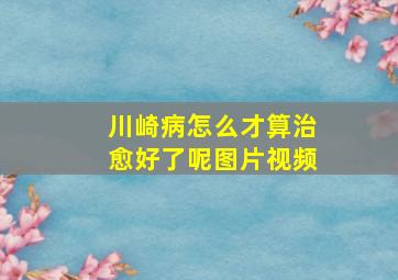 川崎病怎么才算治愈好了呢图片视频