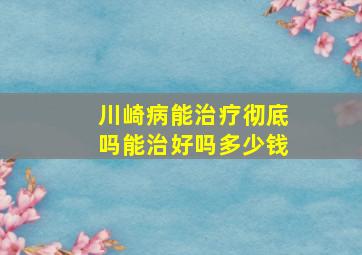 川崎病能治疗彻底吗能治好吗多少钱