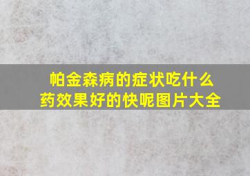 帕金森病的症状吃什么药效果好的快呢图片大全