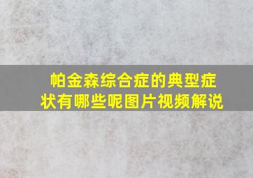 帕金森综合症的典型症状有哪些呢图片视频解说