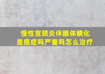 慢性宫颈炎伴腺体鳞化是癌症吗严重吗怎么治疗