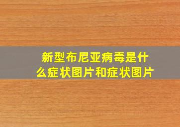 新型布尼亚病毒是什么症状图片和症状图片