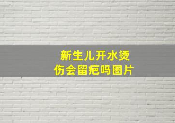 新生儿开水烫伤会留疤吗图片