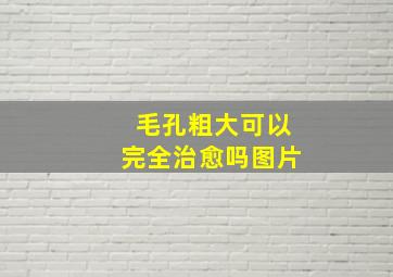 毛孔粗大可以完全治愈吗图片