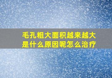 毛孔粗大面积越来越大是什么原因呢怎么治疗