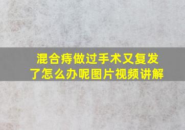 混合痔做过手术又复发了怎么办呢图片视频讲解