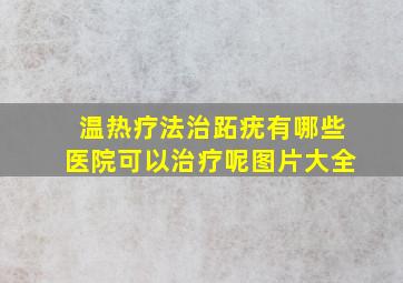 温热疗法治跖疣有哪些医院可以治疗呢图片大全