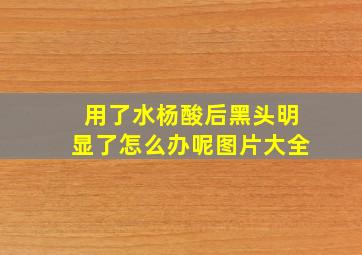 用了水杨酸后黑头明显了怎么办呢图片大全