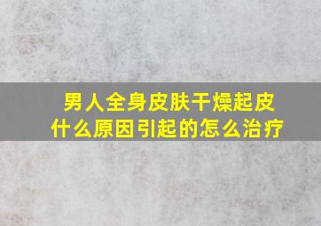 男人全身皮肤干燥起皮什么原因引起的怎么治疗