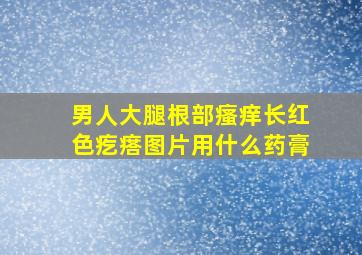 男人大腿根部瘙痒长红色疙瘩图片用什么药膏