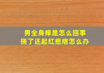 男全身痒是怎么回事挠了还起红疙瘩怎么办