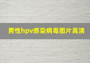 男性hpv感染病毒图片高清