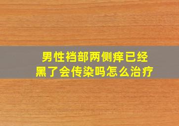 男性裆部两侧痒已经黑了会传染吗怎么治疗