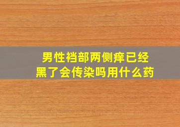 男性裆部两侧痒已经黑了会传染吗用什么药