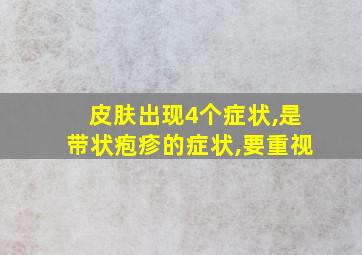 皮肤出现4个症状,是带状疱疹的症状,要重视