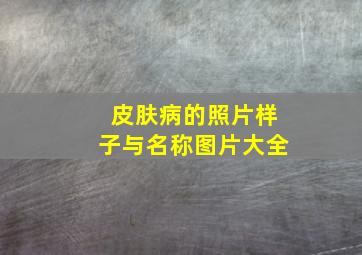 皮肤病的照片样子与名称图片大全