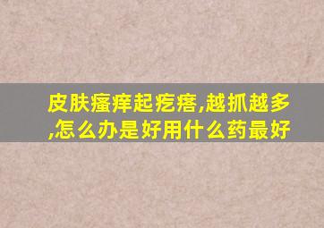 皮肤瘙痒起疙瘩,越抓越多,怎么办是好用什么药最好