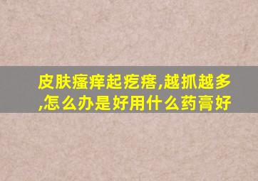 皮肤瘙痒起疙瘩,越抓越多,怎么办是好用什么药膏好