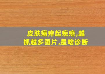 皮肤瘙痒起疙瘩,越抓越多图片,是啥诊断