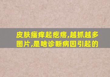 皮肤瘙痒起疙瘩,越抓越多图片,是啥诊断病因引起的