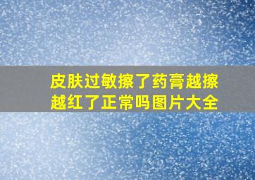 皮肤过敏擦了药膏越擦越红了正常吗图片大全