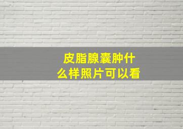 皮脂腺囊肿什么样照片可以看