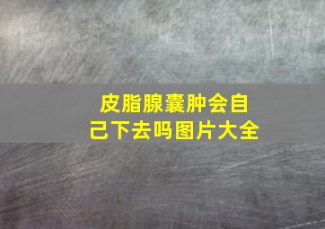 皮脂腺囊肿会自己下去吗图片大全