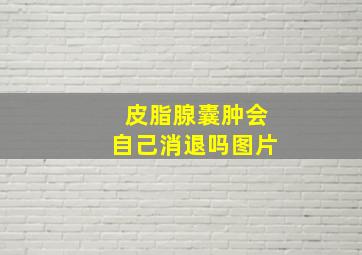 皮脂腺囊肿会自己消退吗图片