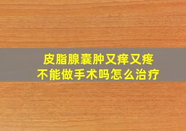 皮脂腺囊肿又痒又疼不能做手术吗怎么治疗